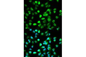 Immunofluorescence analysis of HeLa cell using TCF4 antibody. (TCF4 抗体  (AA 400-500))