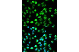 Immunofluorescence analysis of HeLa cell using TCF4 antibody. (TCF4 抗体  (AA 400-500))