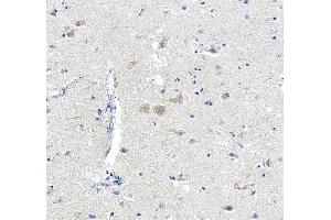 IHC analysis of SCN11A using anti-SCN11A antibody (ABIN7603132).