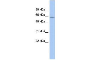 WB Suggested Anti-LEMD2 Antibody Titration: 0. (LEMD2 抗体  (Middle Region))