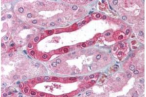 Human Kidney (formalin-fixed, paraffin-embedded stained with CA2 antibody ABIN214022 at 5 ug/ml followed by biotinylated goat anti-rabbit IgG secondary antibody ABIN481713, alkaline phosphatase-streptavidin and chromogen. (CA2 抗体)