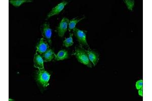 Immunofluorescence (IF) image for anti-Calponin 3, Acidic (CNN3) (AA 2-329) antibody (ABIN7146559)