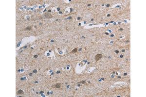 Immunohistochemistry (IHC) image for anti-Tonsoku-Like, DNA Repair Protein (NFKBIL2) antibody (ABIN2427657) (NFKBIL2 抗体)