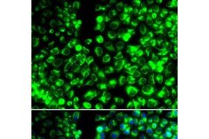 Immunofluorescence analysis of HeLa cells using CALU Polyclonal Antibody (CALU 抗体)