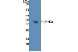 Detection of Recombinant TNPO1, Human using Polyclonal Antibody to Transportin 1 (TNPO1) (Transportin 1 抗体  (AA 626-836))