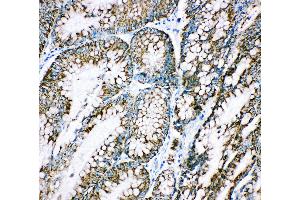 Immunohistochemistry (IHC) image for anti-Heat Shock 10kDa Protein 1 (Chaperonin 10) (HSPE1) (AA 81-102), (C-Term) antibody (ABIN3044176)