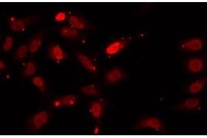Immunofluorescence analysis of U2OS cells using HNRNPF Polyclonal Antibody (HNRNPF 抗体)