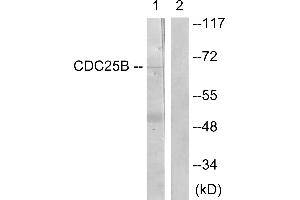 Immunohistochemistry analysis of paraffin-embedded human brain tissue using CDC25B (Ab-353) antibody. (CDC25B 抗体  (Ser353))
