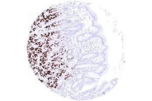 Moderate to strong MUC6 positivity in the mucous secreting glands but not the surface epithelium of the stomach (Recombinant MUC6 抗体)