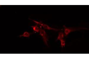 ABIN6274838 staining HeLa cells by IF/ICC. (Amphiphysin 抗体  (Internal Region))