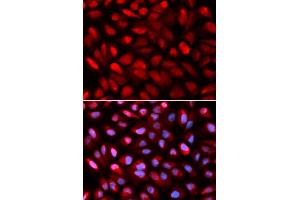 Immunofluorescence analysis of U2OS cells using PCBP2 antibody.