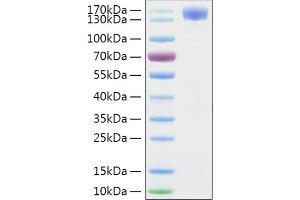 SDS-PAGE (SDS) image for SARS-CoV-2 Spike S1 (Active) protein (His tag,Fc Tag) (ABIN6952732)