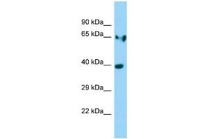 WB Suggested Anti-Ldha Antibody Titration: 1. (Lactate Dehydrogenase A 抗体  (Middle Region))