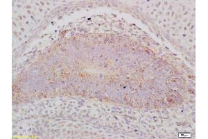 Formalin-fixed and paraffin embedded mouse embryo labeled with Anti-ABCA12 Polyclonal Antibody, Unconjugated (ABIN1386605) at 1:200 followed by conjugation to the secondary antibody and DAB staining (ABCA12 抗体  (AA 2051-2200))