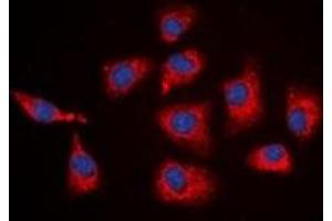Immunofluorescent analysis of SGK1 staining in HEK293T cells. (SGK1 抗体  (C-Term))