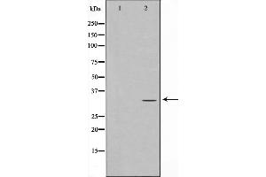 Western blot analysis of RFA2 phosphorylation expression in Adriamycin treated HeLa whole cell lysates,The lane on the left is treated with the antigen-specific peptide. (RPA2 抗体  (pThr21))