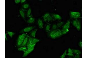 Immunofluorescent analysis of Hela cells using ABIN7163052 at dilution of 1:100 and Alexa Fluor 488-congugated AffiniPure Goat Anti-Rabbit IgG(H+L) (PHF21A 抗体  (AA 312-487))