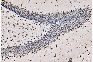 IHC analysis of CPSF6 using anti-CPSF6 antibody (ABIN7601898).