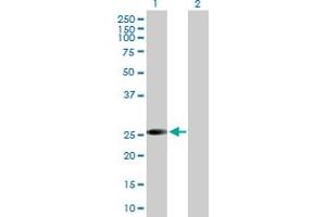 Western Blot analysis of VAPB expression in transfected 293T cell line by VAPB MaxPab polyclonal antibody.