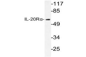 Western blot (WB) analysis of IL-20Rlha antibody in extracts from HepG2 cells.