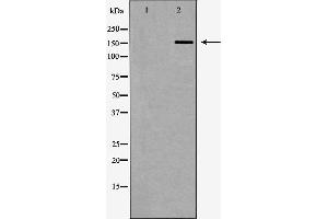 Western blot analysis of Hela whole cell lysates, using FANCD2 Antibody. (FANCD2 抗体  (Internal Region))