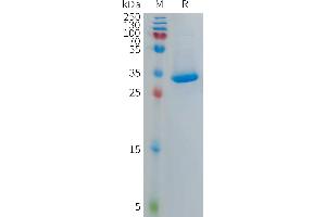 Platelet Factor 4 Variant 1 (PF4V1) (AA 31-104) protein (Fc Tag)