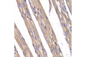 Immunohistochemistry of paraffin-embedded rat heart using FXN antibody (ABIN5970875) at dilution of 1/100 (40x lens). (Frataxin 抗体)