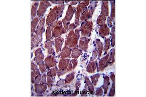 FIZ1 Antibody (C-term) (ABIN657429 and ABIN2846463) immunohistochemistry analysis in formalin fixed and paraffin embedded human skeletal muscle followed by peroxidase conjugation of the secondary antibody and DAB staining. (FIZ1 抗体  (C-Term))