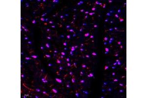 Immunofluorescence of paraffin embedded mouse heart using TYW1B (ABIN7076025) at dilution of 1: 650 (400x lens) (TYW1B 抗体)
