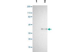 Western blot analysis of Lane 1: Human cell line RT-4, Lane 2: Human cell line U-251MG sp with SPARC polyclonal antibody . (SPARC 抗体)