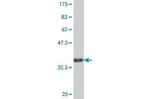 Western Blot detection against Immunogen (36. (CADPS 抗体  (AA 1256-1353))