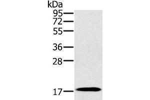 Western Blot analysis of Mouse heart tissue using RNF122 Polyclonal Antibody at dilution of 1:300 (RNF122 抗体)