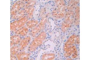 Figure. (JAK2 抗体  (AA 508-800))