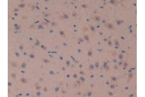 IHC-P analysis of Mouse Brain Tissue, with DAB staining. (SOSTDC1 抗体  (AA 24-206))