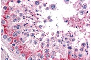 Human Testis: Formalin-Fixed, Paraffin-Embedded (FFPE) (TLN1 抗体  (AA 1052-1150))