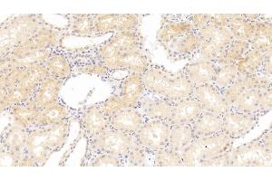 Detection of LOX in Human Kidney Tissue using Polyclonal Antibody to Lysyl Oxidase (LOX) (LOX 抗体  (AA 213-417))