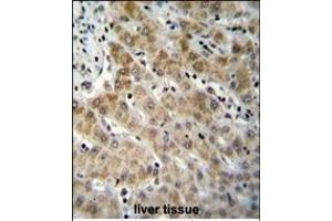 EDN1 Antibody (C-term) (ABIN655912 and ABIN2845311) immunohistochemistry analysis in formalin fixed and paraffin embedded human liver tissue followed by peroxidase conjugation of the secondary antibody and DAB staining. (Endothelin 1 抗体  (C-Term))