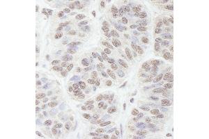 Immunohistochemistry (IHC) image for anti-Guanine Nucleotide Binding Protein-Like 3 (Nucleolar) (GNL3) (AA 1-50) antibody (ABIN7453608)