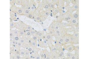 Immunohistochemistry of paraffin-embedded Rat liver using CD98 Polyclonal Antibody at dilution of 1:100 (40x lens).