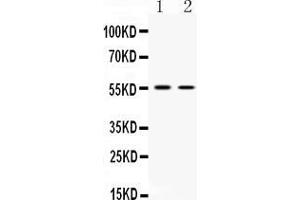 Western blot analysis of SLC18A3 expression in HELA whole cell lysates ( Lane 1) and HEPA whole cell lysates ( Lane 2). (SLC18A3 抗体  (N-Term))