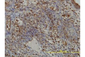 Immunoperoxidase of monoclonal antibody to GART on formalin-fixed paraffin-embedded human endometrium tissue. (GART 抗体  (AA 1-433))