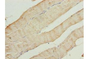 Immunohistochemistry of paraffin-embedded human skeletal muscle tissue using ABIN7143358 at dilution of 1:100 (CAP2 抗体  (AA 221-477))