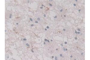 Immunohistochemistry (IHC) image for anti-Annexin A11 (ANXA11) (AA 1-505) antibody (ABIN7435868)