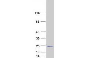 Western Blotting (WB) image for Olfactory Marker Protein (OMP) protein (Myc-DYKDDDDK Tag) (ABIN2727894)