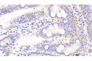 Immunohistochemistry (IHC) image for anti-Tight Junction Protein 2 (Zona Occludens 2) (TJP2) (AA 307-669) antibody (ABIN7441247)