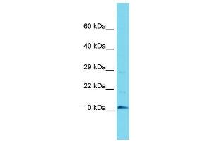 Western Blotting (WB) image for anti-Chromosome 9 Open Reading Frame 170 (C9ORF170) (N-Term) antibody (ABIN2156511) (C9ORF170 抗体  (N-Term))