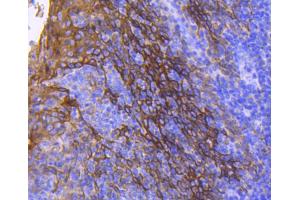 Paraformaldehyde-fixed, paraffin embedded human tonsil, Antigen retrieval by boiling in sodium citrate buffer (pH6) for 15min, Block endogenous peroxidase by 3% hydrogen peroxide for 30 minutes, Blocking buffer at 37°C for 20min, Antibody incubation with Cytokeratin 13 (5A3) Monoclonal Antibody  at 1:50 overnight at 4°C, followed by a conjugated secondary and DAB staining. (Cytokeratin 13 抗体)