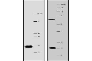 Western Blotting (WB) image for anti-Processing of Precursor 7, Ribonuclease P/MRP Subunit (POP7) antibody (ABIN1108698)