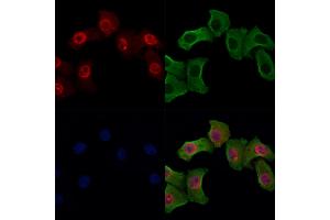 Phospho-Bub1 (Ser459) Antibody staining Hela cells(heat shock treatment) by IF/ICC. (BUB1 抗体  (pSer459))