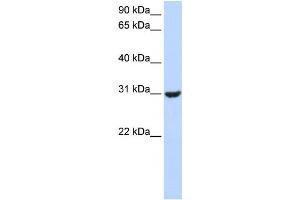 Western Blotting (WB) image for anti-Ring Finger Protein 182 (RNF182) antibody (ABIN2458750) (RNF182 抗体)